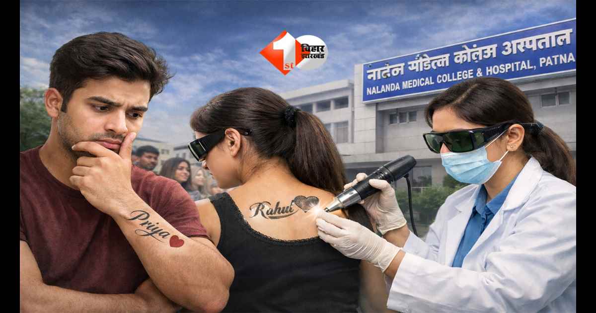 BIHAR NEWS : शादी से पहले मुसीबत बना Love Tattoo! हटाने उमड़ रही भीड़, इस जगह हो रहा मुफ्त इलाज