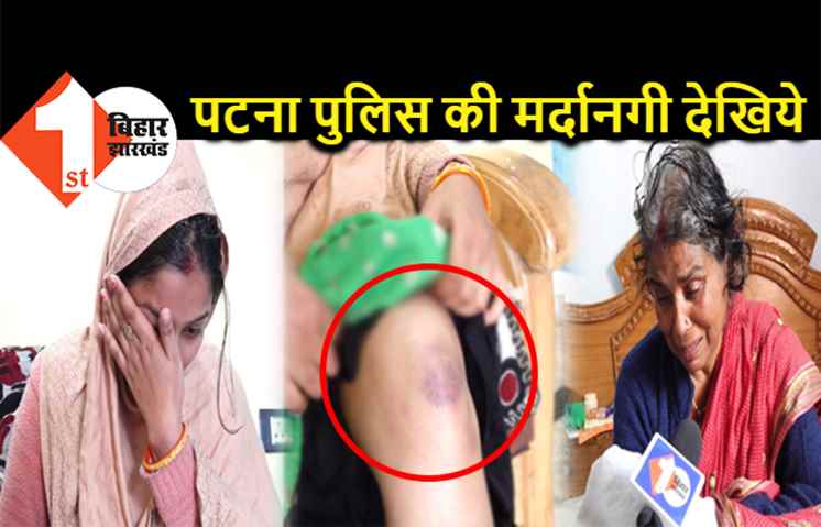 शर्मनाक! पटना पुलिस ने डंडे से देह फुलाया, ऋतुराज की मां बोली- थाने में बहू को बाल पकड़कर घसीटा और कपड़ा उतारकर घुटने पर मारा