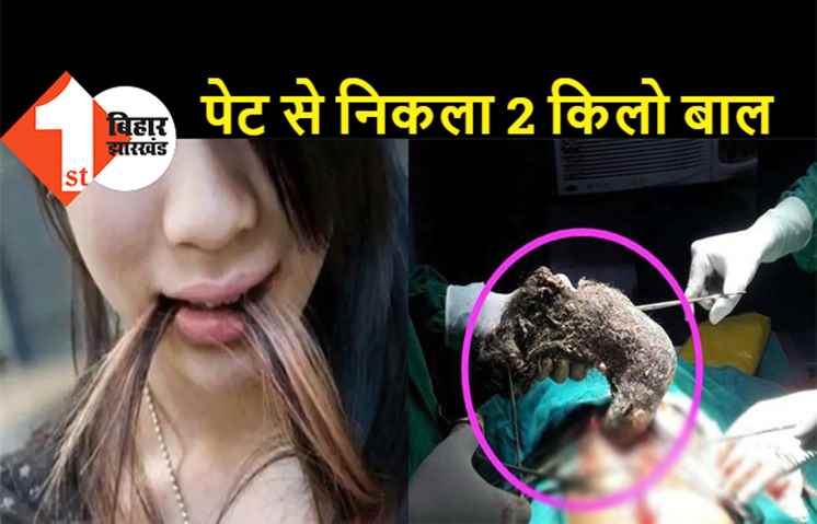 लड़की को बचपन से थी बाल खाने की आदत, पेट से निकला 2 किलो बाल, देखकर हैरान रह गए डॉक्टर