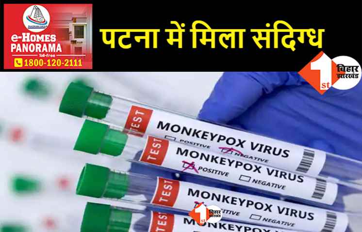 पटना में मिला मंकीपॉक्स का संदिग्ध मरीज, महिला के घर पहुंची PMCH की टीम  