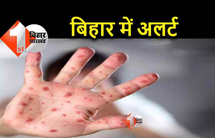 मंकीपॉक्‍स को लेकर स्वास्थ्य विभाग ने जारी की गाइडलाइन, पटना को किया अलर्ट