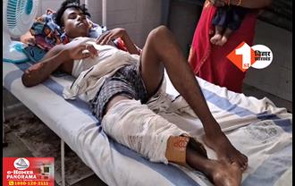 स्वास्थ्य विभाग का नया कारनामा : टूटे हुए पैर में प्लास्टर की जगह लगा दिया कार्टन : बिहार के एक बड़े अस्पताल का मामला