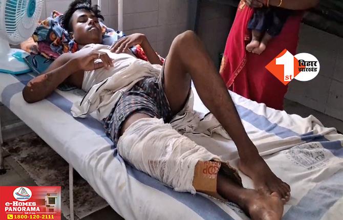 स्वास्थ्य विभाग का नया कारनामा : टूटे हुए पैर में प्लास्टर की जगह लगा दिया कार्टन : बिहार के एक बड़े अस्पताल का मामला
