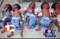 महिला ने एक साथ 5 बेटियों को दिया जन्म : सभी नवजात स्वस्थ्य : किशनगंज में 20 साल की उम्र में बनी 6 बच्चों की मां