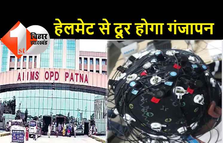 पटना AIIMS ने बनाया ऐसा हेलमेट जो गंजेपन दूर कर देगा: रोजाना 3 घंटे पहनिये, 4 महीने में बाल उग आयेंगे