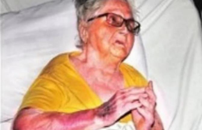 104 साल की महिला ने कोरोना को हराया, फेफड़ों में भी हो गया था संक्रमण