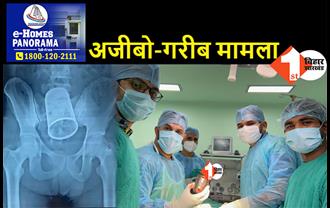 मलद्वार से निकाला गया स्टील का ग्लास, PMCH में युवक का हुआ सफल ऑपरेशन