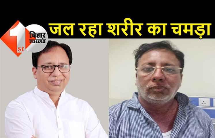 जानलेवा बीमारी के तीसरे स्टेज में संजय जायसवाल: जल रहा उनका शरीर, खुद बताया... ये दवाई खाने से हुई यह खतरनाक बीमारी
